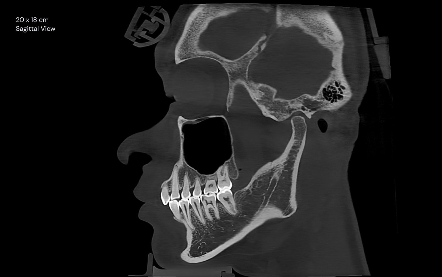 20 x 18 cm sagittal view